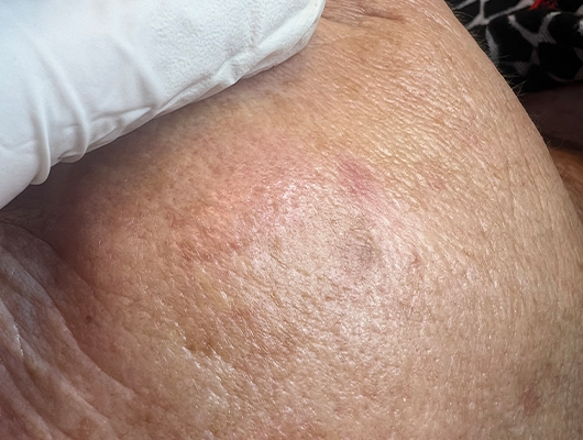 Untitled-1-Recovered-Recovered-Recovered-Recoveredxcvbh