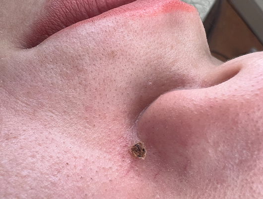 Untitled-1-Recovered000